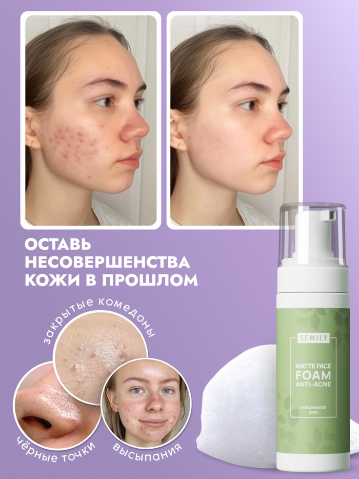 Пенка для умывания матирующая SEMILY против акне, 150 мл 10923987